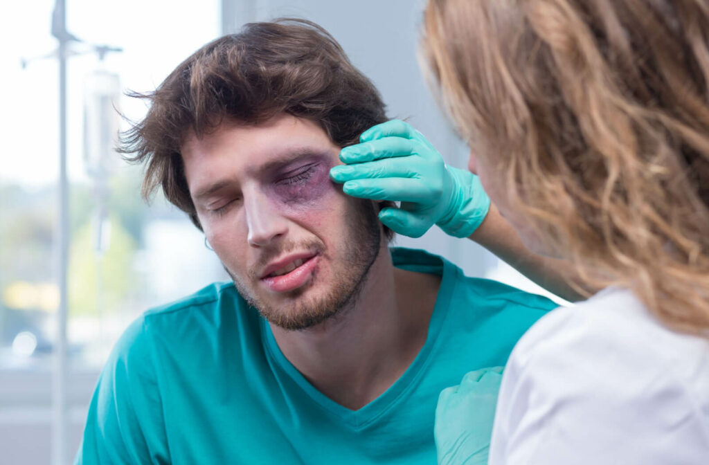 A male patient at the hospital with a black eye. A serious eye injury could result in cataracts forming immediately or years later.